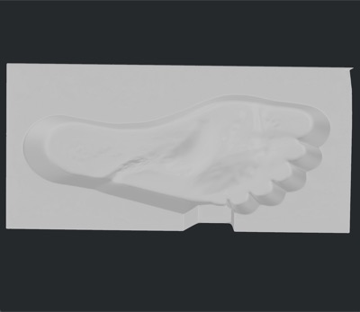 Custom Orthotics 3D